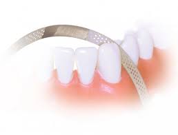 Polyester strip in handy dispenser for all anterior teeth filling materials. Perforated Diamond Finishing Strips Kerr Dental