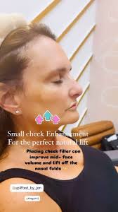 Ready to restore lift and revitalize your look? Our cheek filler  enhancement is designed to bring back that youthful glow and sculpted  contour. Book your appointment with Uplifted by Jen and ...
