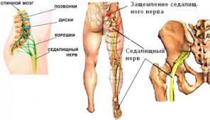 Chem Lechit Sedalishnyj Nerv Pri Ego Zashemlenii Nervy V Poryadke Yandeks Dzen