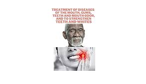 Find out during your appointment. Treatment Of Diseases Of The Mouth Gums Teeth And Mouth Odor And To Strengthen Teeth And Whites Dr Sebi Cure Dr Sebi 9798727938508 Amazon Com Books