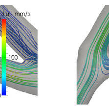 Nekomata is a demon in the series. Pdf Transapical Aortic Valve Implantation Risk Assessment With The Euroscore Ii Model In 679 Patients And Implication For Patient Selection