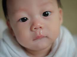 We did not find results for: 10 Petua Hilangkan Kahak Bayi Mama Boleh Cuba Dalam Rumah