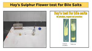 Bee & flower shanghai sulfur soap face and body bar soaps 3.4 oz (4 packs). Hay S Sulphur Flower Test For Bile Salts In Urine Hay S Sulphur Powder Test Youtube
