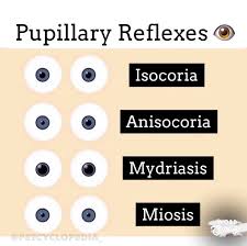 Image result for Mydriasis