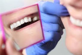 We did not find results for: Dry Socket Prevention Caring For Yourself After An Extraction Advanced Oral Facial Specialists