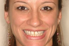 Cosmetic Dentistry in Virginia Beach, VA