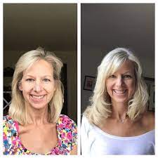 Two months ago, my prescription came in a different bottle. Breast Cancer Topic Thin Hair I Just Tried Something New