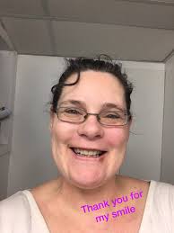 Well today I got the last 17 teeth pulled and had a mandibular tori removed  at the same time. I was in at 10:30 am and out by 1:35pm. I am still