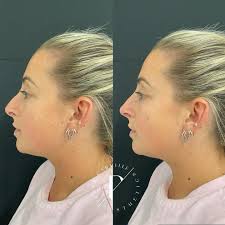 Penny Carville Aesthetics