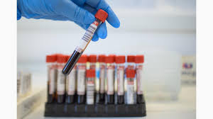 We did not find results for: Hepatita C Romania Pe Primul Loc In Europa ProvidenÈ›a PoliclinicÄƒ È™i Spital