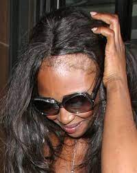 Why Do Black Women Want To Look White Google Search Damaged Black Hair Natural Hair Styles Edges Hair