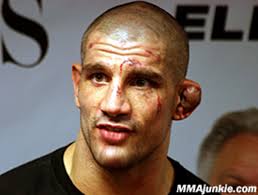 2) hasim rahman vs evander holyfield. Antonio Margarito And The 15 Most Brutal Looking Post Fight Faces Bleacher Report Latest News Videos And Highlights