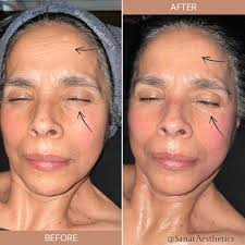 Jenise Rodriguez (@sanaraesthetics) • Instagram photos and videos