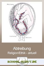 Wo es um beginn oder ende des lebens von menschlichen personen geht, muß man sich immer bewußt bleiben, dass sich die in diesem zusammenhang verwendeten. Schwangerschaft Abtreibung Wann Beginnt Menschliches Leben