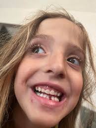 What is the significance of a 2nd tooth anniversary?