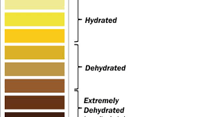 Dalam keadaan minum banyak air, air kencing boleh menjadi jelas atau tidak berwarna. Usai Buang Air Kecil Perhatikan Warna Urine Health Liputan6 Com