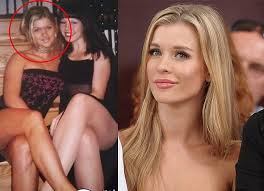 Joanna opozda wraca do siebie po rozstaniu. Tak Wygladala Krupa Przed Operacjami Ladna Pudelek