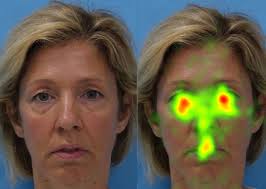 Image result for Visual Fixation