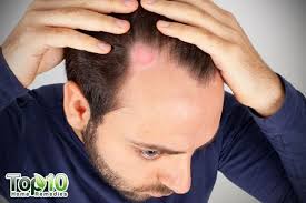Do hand sanitizers actually work at killing disease causing microbes? 7 Home Remedies To Fight Ringworm Of The Scalp Top 10 Home Remedies