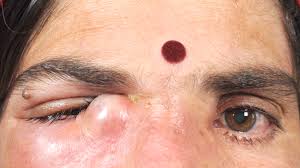 Jorm has some pretty eyes under that mask. Eye Cancer The Art And Science Of Beautiful Eyes