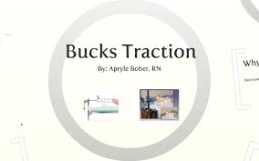 How to apply bucks traction and education. Bucks Traction By Apryle Bober