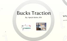 Definition a longitudinal skin traction applied to extremity in one direction with a single pulley, and keeping the leg in extended position without hip flexion. Bucks Traction By Apryle Bober