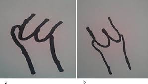 Image result for cervix position