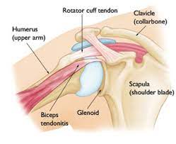 We did not find results for: Biceps Tendinitis Brisbane Knee And Shoulder Clinic Dr Macgroartybrisbane Knee And Shoulder Clinic