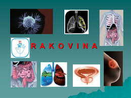 Karcinóm pľúc je zároveň najčastejšia príčina úmrtia u mužov spomedzi všetkých rakovín a to paradoxne, keďže pred sto rokmi bola jedna z najmenej rozšírených. Ppt C I N S K A S T U D I A Powerpoint Presentation Free Download Id 4929113