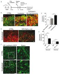 Learn about bone cancer by understanding normal bone tissue, how bone cancer develops, and the various types of bone cancer. Hematopoietic Stem And Progenitor Cells Use Podosomes To Transcellularly Cross The Bone Marrow Endothelium Haematologica