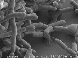 Inflammatory Bowel Disease A Gut Bacterium With Beneficial Properties Newsroom Inserm