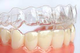 How long to wear retainers after invisalign. How Many Hours A Day Will I Need To Wear My Invisalign Retainers Dentist In Leawood Ks Local Dentist For You And Your Family