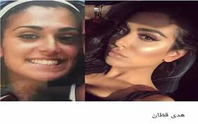 هل اقتصر الأمر على عمليتين؟ Ø§Ù„Ù…Ø´Ø§Ù‡ÙŠØ± Ù‚Ø¨Ù„ ÙˆØ¨Ø¹Ø¯ Ø§Ù„ØªØ¬Ù…ÙŠÙ„