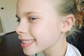 Fundraiser for Ashleigh Grubb by CJ Keppel : Evy Grubb's Cochlear Upgrade