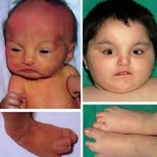 Daniel NATERA-DE BENITO