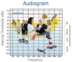 What Is An Audiogram