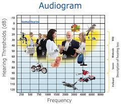 what is an audiogram