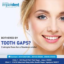 Dr. Anjali Dave Tiwari She specializes in TMJ surgery with a 35 years of  field experience in Dentistry. Timings- 9am to 1pm and 5pm-8pm (Mon- Fri)  For appointment- 0141-2621394 , 9610359636 (Sunday