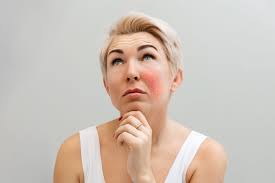 Lumecca for Rosacea and Redness: A Game-Changer for Sensitive Skin