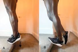 I developed some tendonitis (or should i say tendonosis) in my right achilles last summer which would periodically. Achilles Tendinopathy A Guide For General Practice British Journal Of General Practice