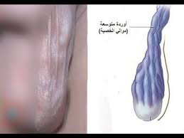 Doctor S Notes تعرف معنا علي تشخيص دوالي الخصية يتم Facebook
