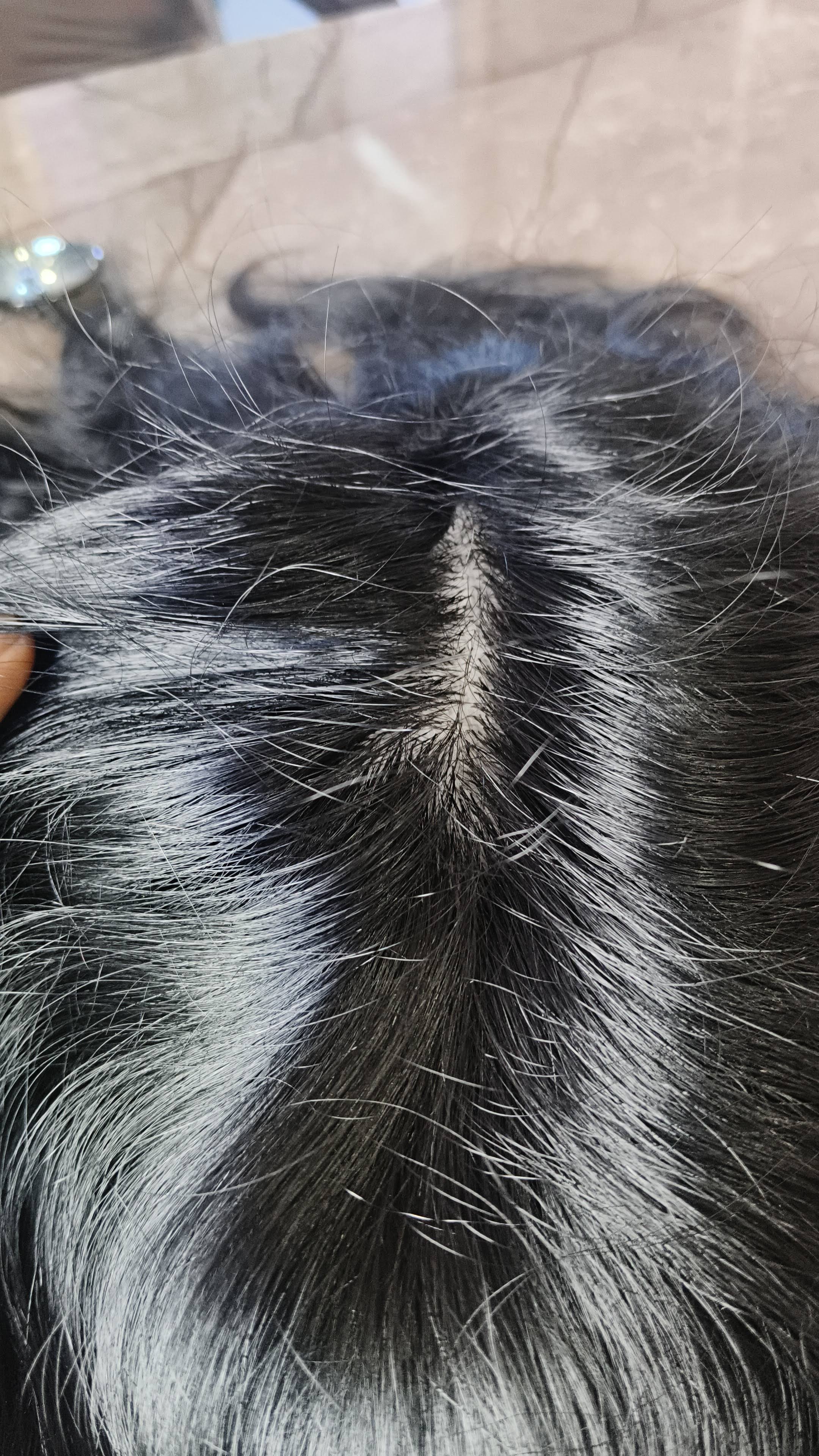 Best trading Hair system product image