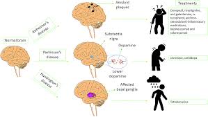 Treatment Of Neurodegenerative Disorders Through The Blood Brain Barrier Using Nanocarriers Nanoscale Rsc Publishing