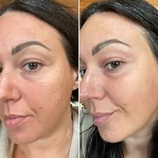 TOP 10 BEST Body Sculpting in Billings, MT