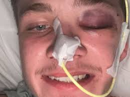 Fundraiser by Ashley Penuell : If you heart leads to help, please donate  here for Alban