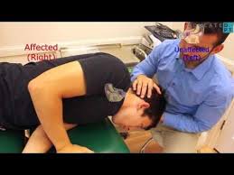 Image result for Canalith Repositioning Procedure