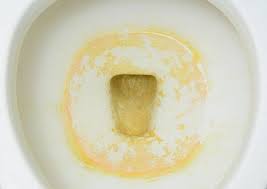 Get Rid Of Limescale Ring Naturally Toilet Bowl Ring Toilet Bowl Ring Remover Toilet Bowl Stains