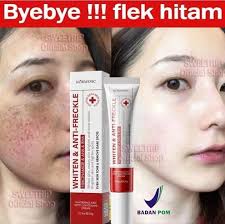 Vaga Servisu Iha Timor-Leste