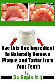 Home Remedies For Plaque And Tartar Buildup Emedihealth Health Oral Health Care Natural Medicine