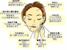 ニキビ吹き出物で体調チェック 吹き出物 場所 ニキビ 場所 ニキビケア